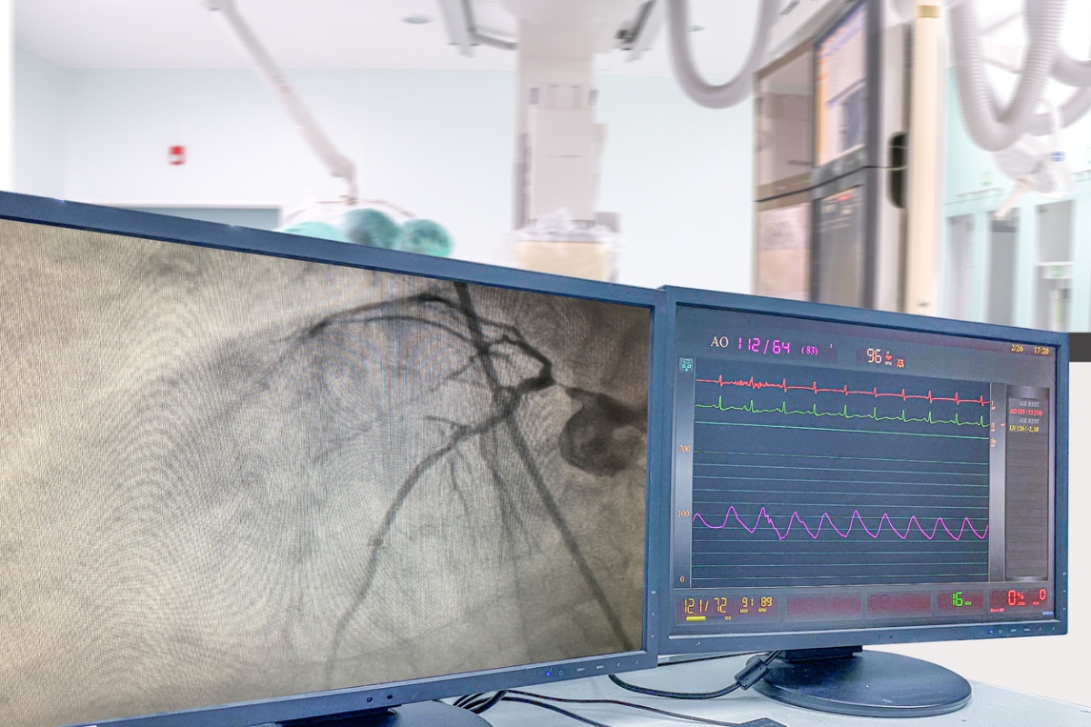 Safety During Procedures in the Radiology Suite